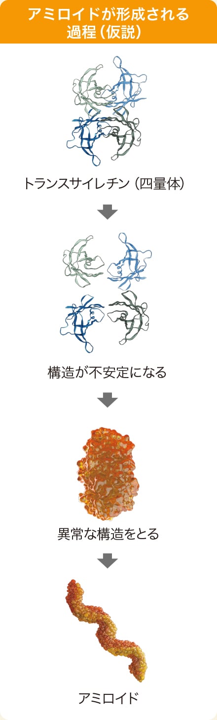 アミロイドが形成される過程（仮説）